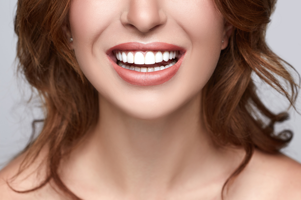 Estetica dentale